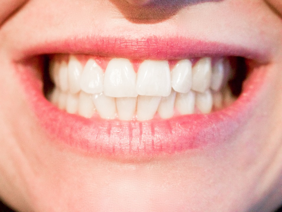 Piękne zęby dzięku leczeniu ortodontycznemu