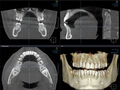 image003-2-400x300