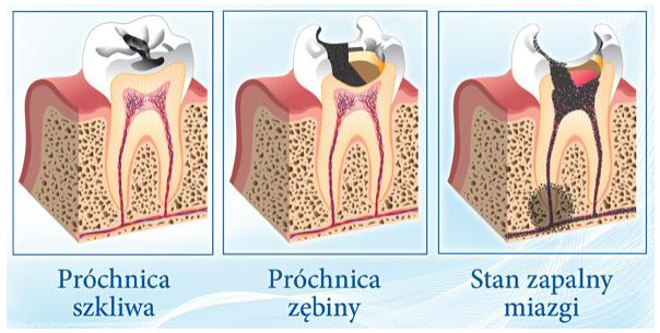 stomatologia1_1490188772