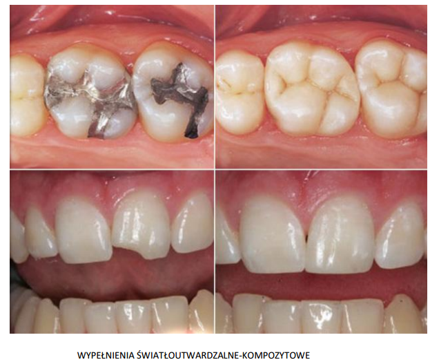 stomatologia2_1490188786